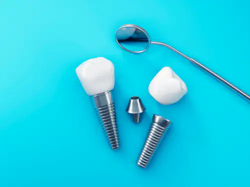 About dental implants in Romeoville, IL